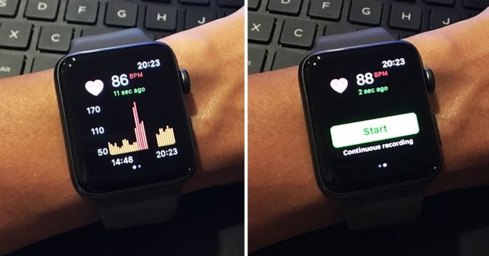 Apple Watches and Sleep Tracking Apps May Cause Bizarre Sleep Disorder