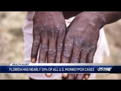 Monkeypox climbs in Florida to 10 percent of all U.S. cases